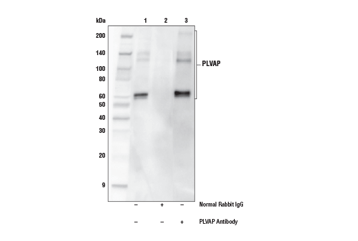 Immunoprecipitation Image 1: PLVAP Antibody