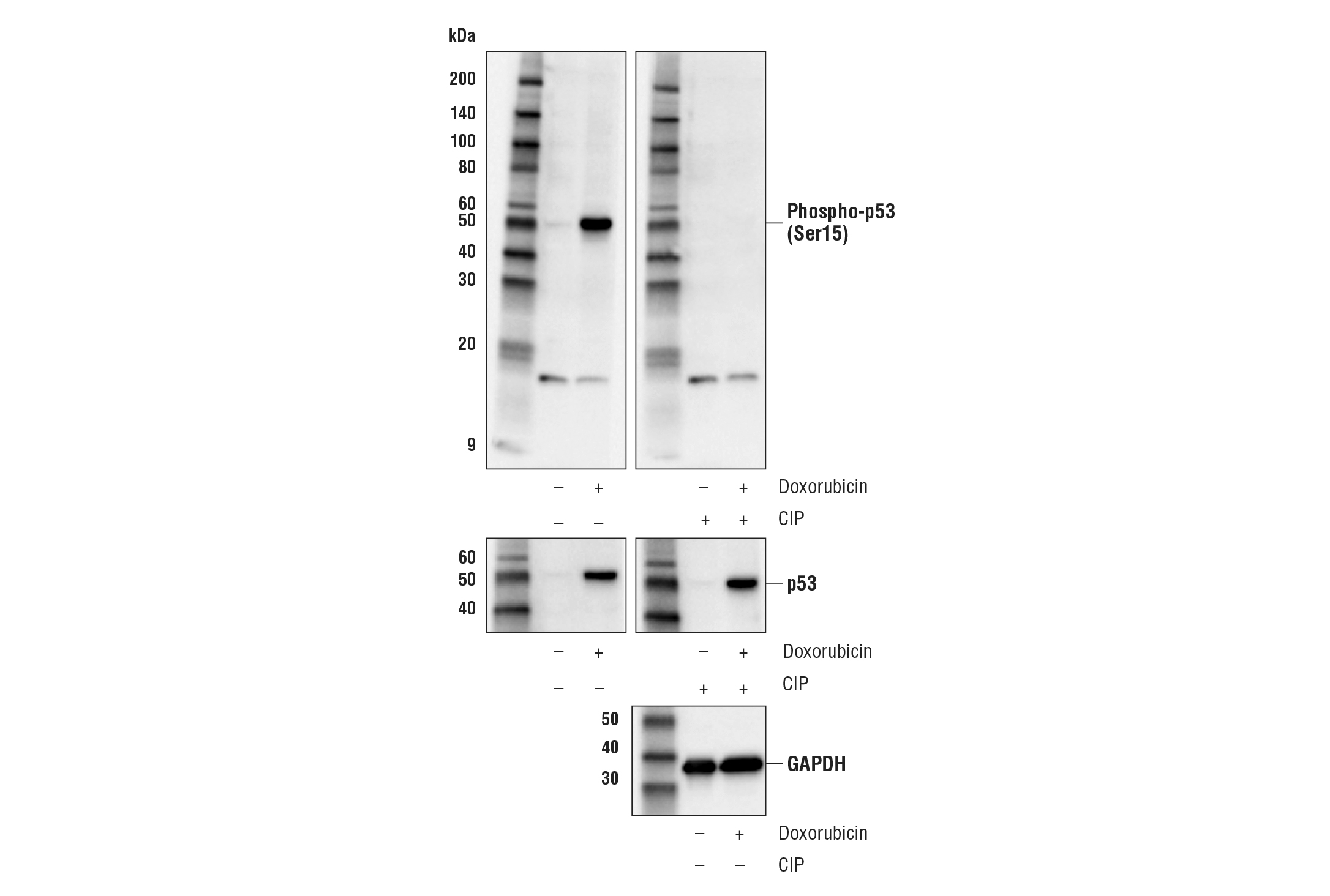 Western Blotting Image 1: Phospho-p53 (Ser15) (E9Y4U) Rabbit mAb