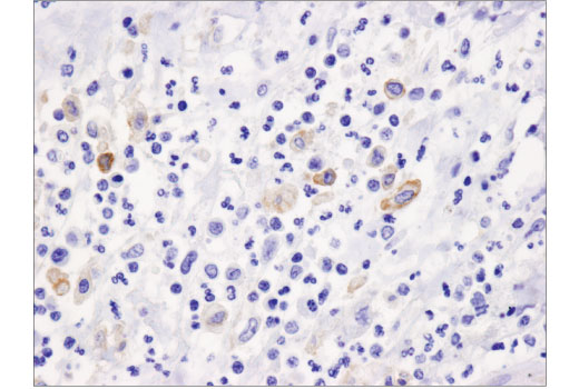 Immunohistochemistry Image 2: PD-L2 (D7U8C™) XP® Rabbit mAb