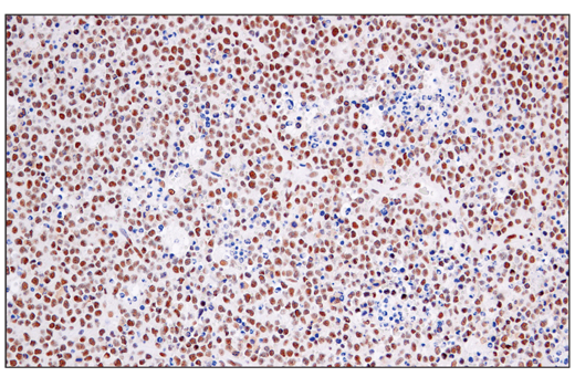 Immunohistochemistry Image 2: ATF-2/ATF-7 (A9G1M) Rabbit mAb