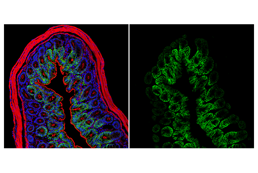 Immunofluorescence Image 2: AQP4 (D1F8E) XP® Rabbit mAb (Alexa Fluor® 488 Conjugate)