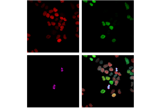 Immunofluorescence Image 2: PCNA (D3H8P) XP® Rabbit mAb (Alexa Fluor® 647 Conjugate)