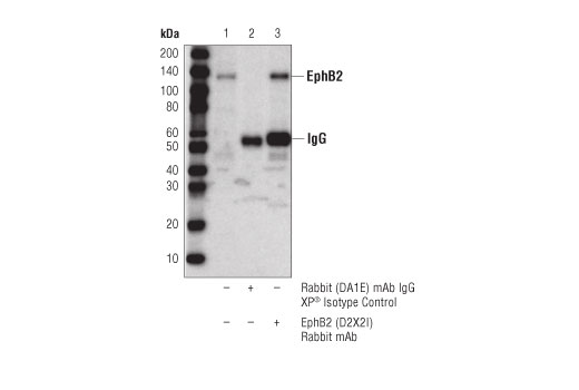 Immunoprecipitation Image 1: EphB2 (D2X2I) Rabbit mAb