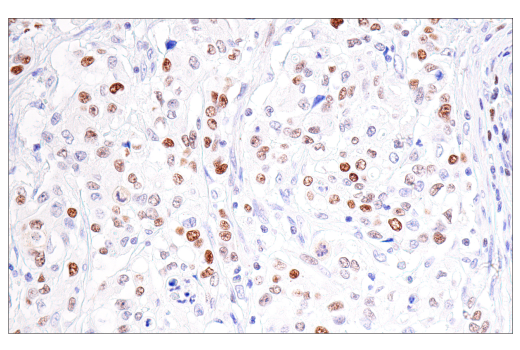 Immunohistochemistry Image 1: FEN-1 (E5X2T) Rabbit mAb