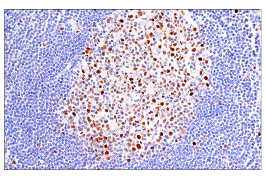 Immunohistochemistry Image 3: FEN-1 (E5X2T) Rabbit mAb