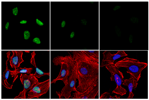 Immunofluorescence Image 1: FEN-1 (E5X2T) Rabbit mAb