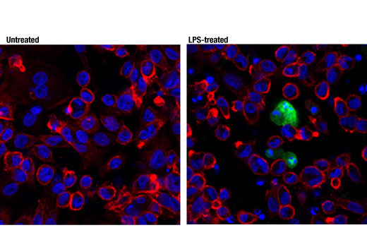 Immunofluorescence Image 1: Cleaved-IL-1β (Asp116) (D3A3Z) Rabbit mAb