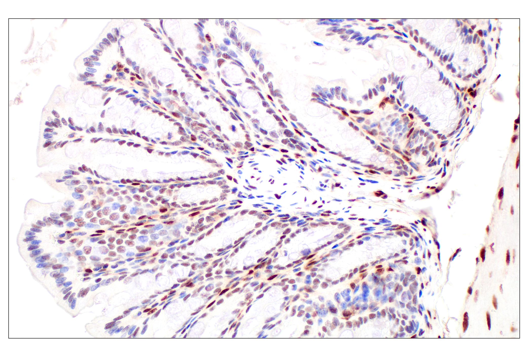Immunohistochemistry Image 15: Basic FGF (E5Y6M) Rabbit mAb (BSA and Azide Free)
