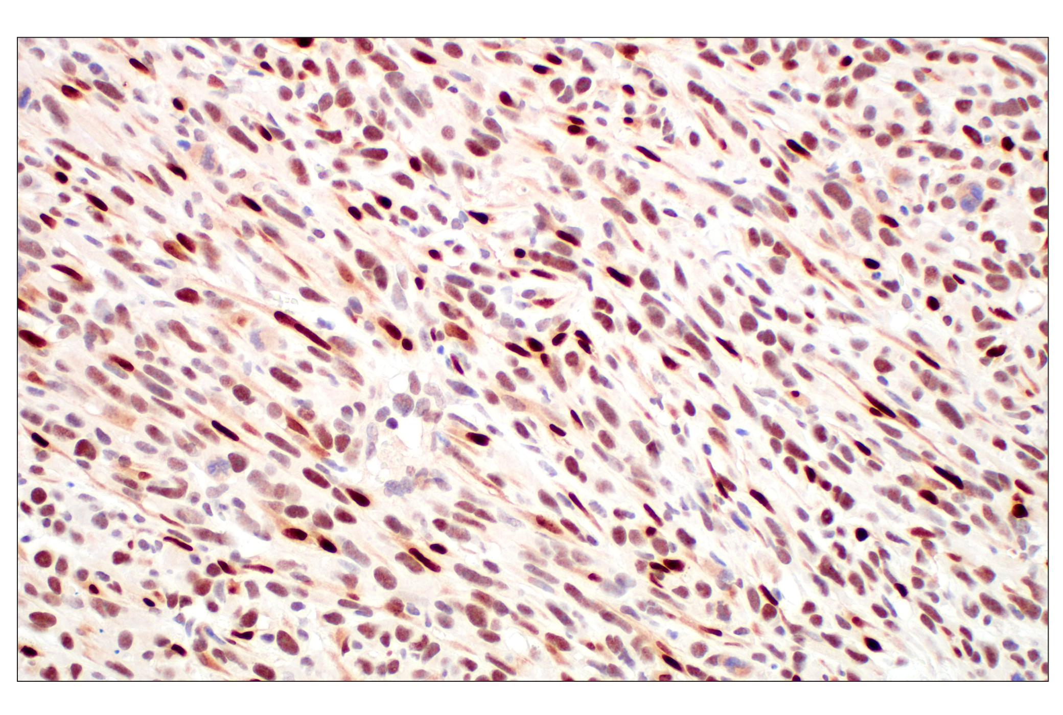 Immunohistochemistry Image 10: Basic FGF (E5Y6M) Rabbit mAb (BSA and Azide Free)