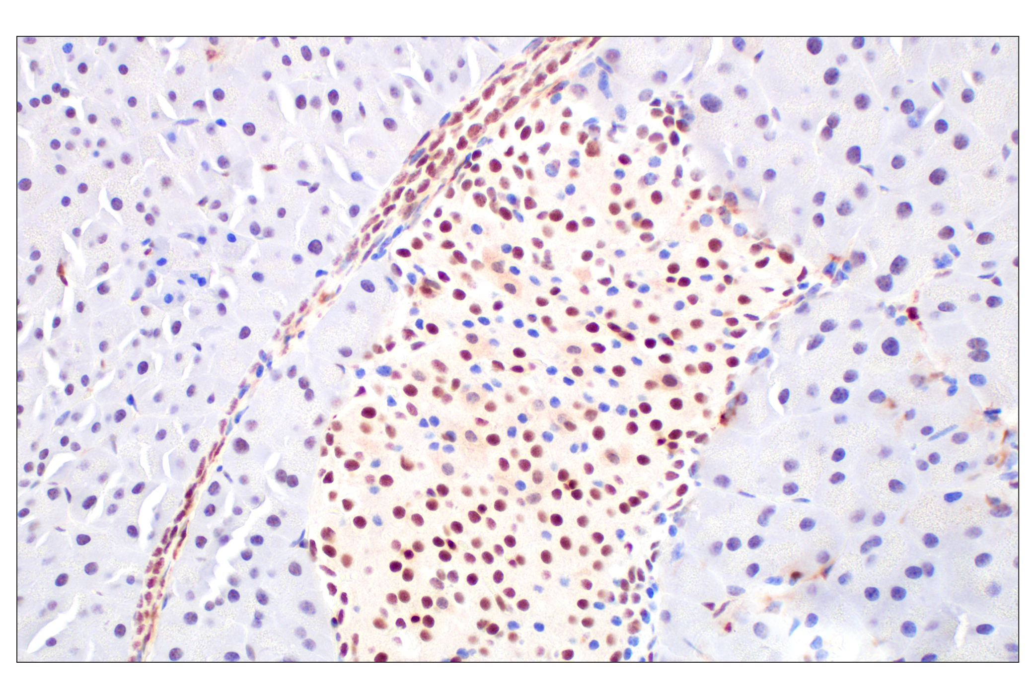 Immunohistochemistry Image 12: Basic FGF (E5Y6M) Rabbit mAb (BSA and Azide Free)