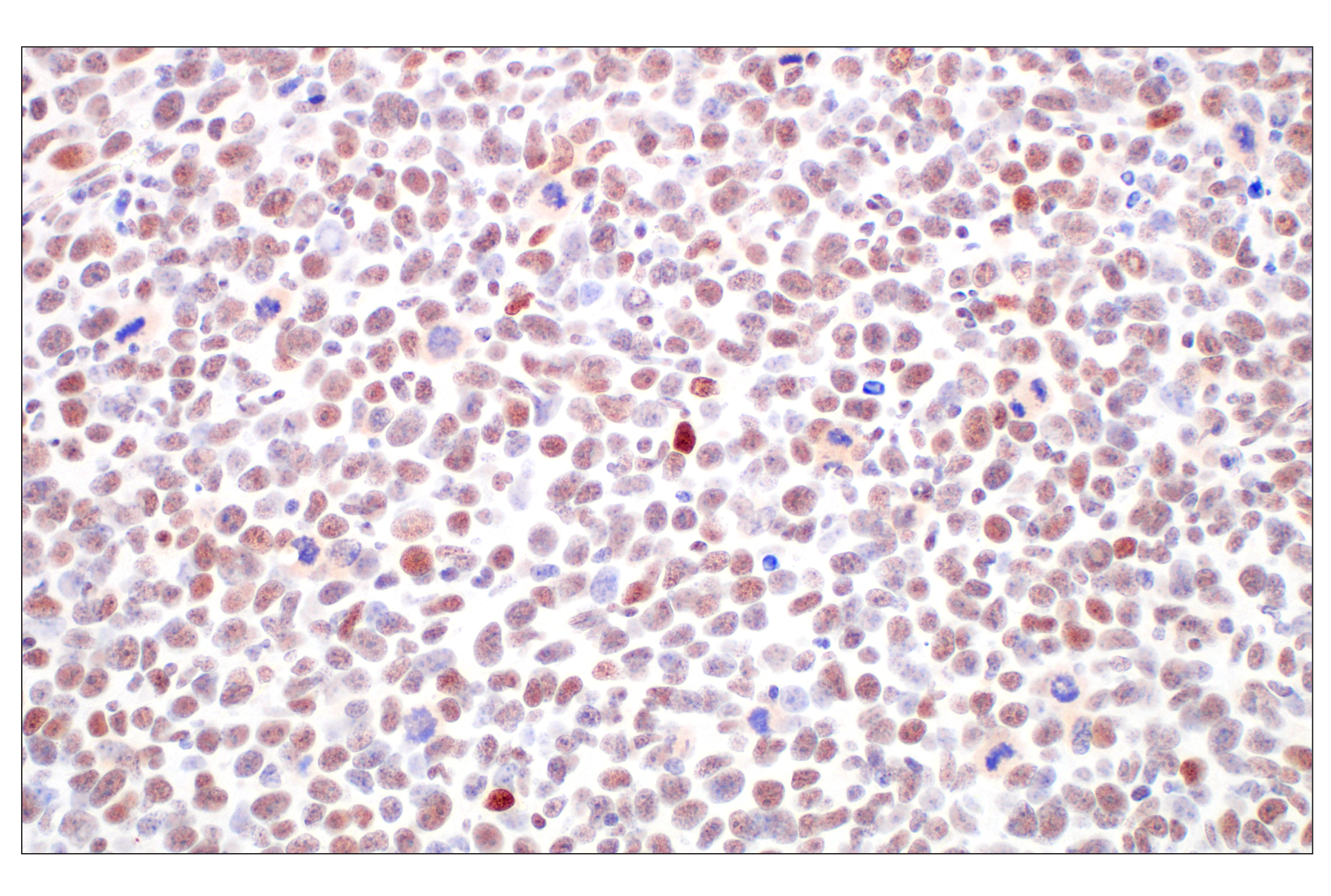 Immunohistochemistry Image 9: Basic FGF (E5Y6M) Rabbit mAb (BSA and Azide Free)