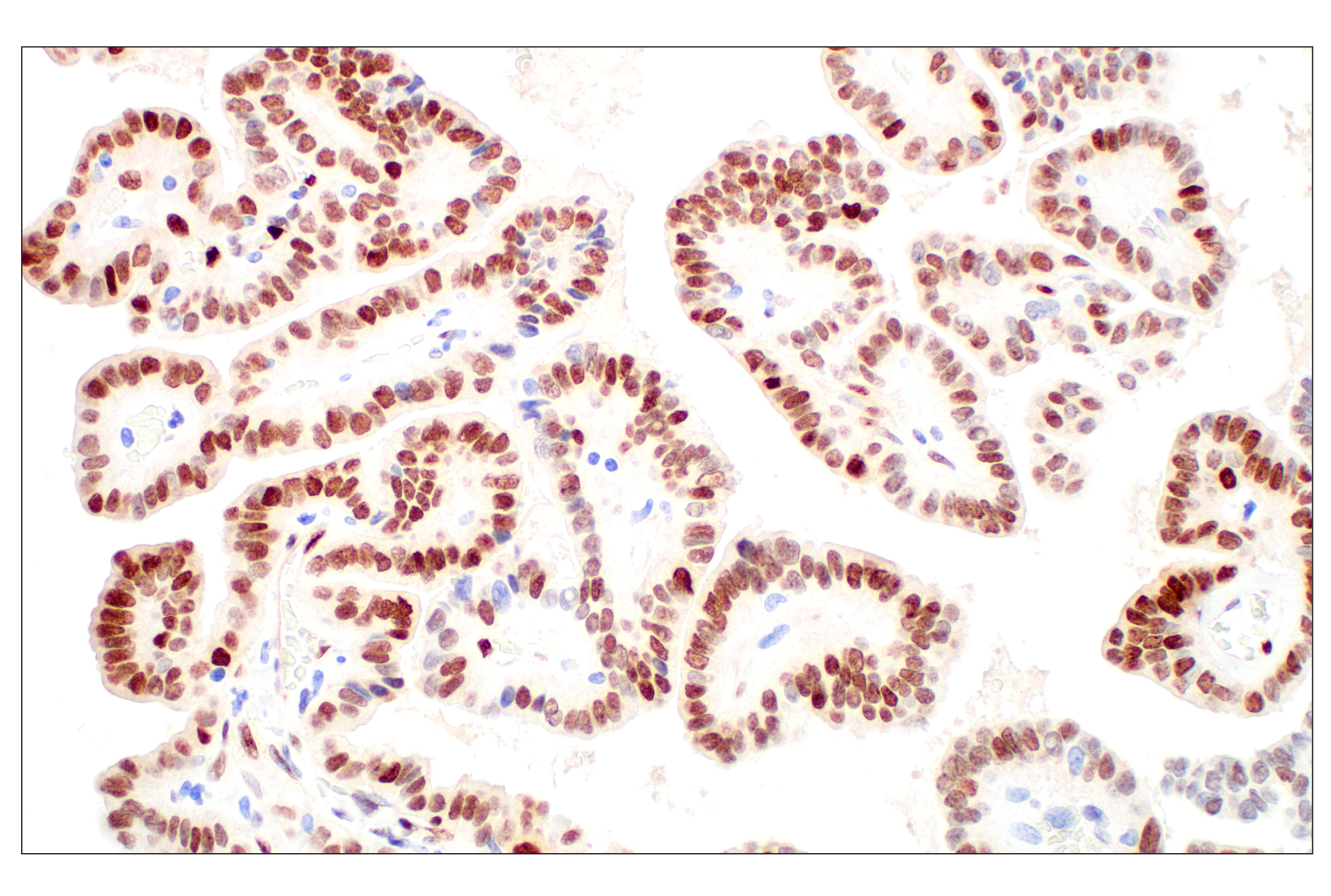 Immunohistochemistry Image 2: Basic FGF (E5Y6M) Rabbit mAb (BSA and Azide Free)