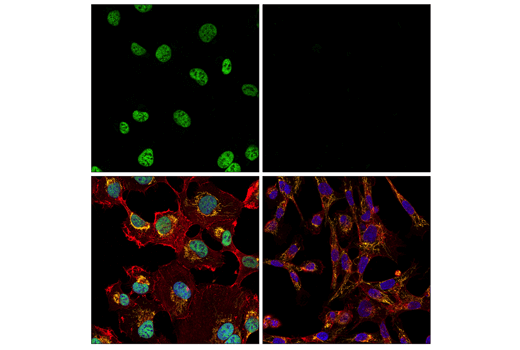 Immunofluorescence Image 1: ZEB1 (E2G6Y) XP® Rabbit mAb (BSA and Azide Free)