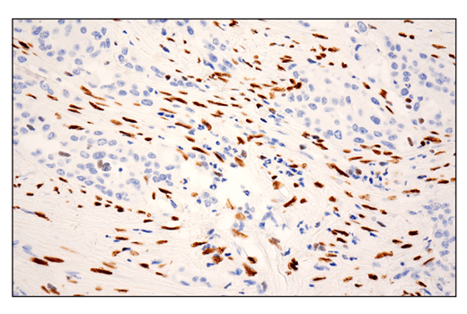Immunohistochemistry Image 1: ZEB1 (E2G6Y) XP® Rabbit mAb (BSA and Azide Free)