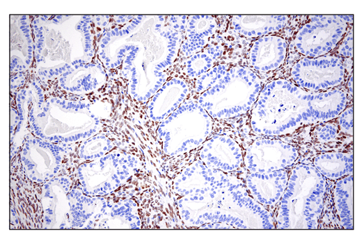 Immunohistochemistry Image 3: ZEB1 (E2G6Y) XP® Rabbit mAb (BSA and Azide Free)