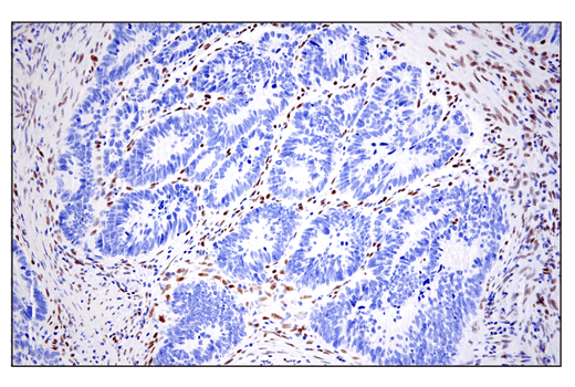 Immunohistochemistry Image 5: ZEB1 (E2G6Y) XP® Rabbit mAb (BSA and Azide Free)