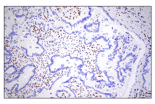 Immunohistochemistry Image 6: ZEB1 (E2G6Y) XP® Rabbit mAb (BSA and Azide Free)
