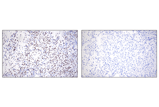 Immunohistochemistry Image 8: ZEB1 (E2G6Y) XP® Rabbit mAb (BSA and Azide Free)