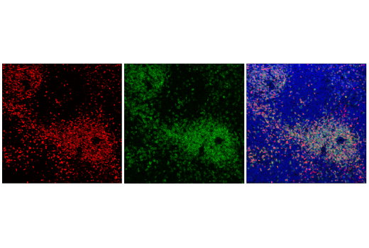 Immunofluorescence Image 2: TCF1/TCF7 (E6O1K) Rabbit mAb (Alexa Fluor® 647 Conjugate)