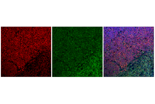 Immunofluorescence Image 1: TCF1/TCF7 (E6O1K) Rabbit mAb (Alexa Fluor® 647 Conjugate)