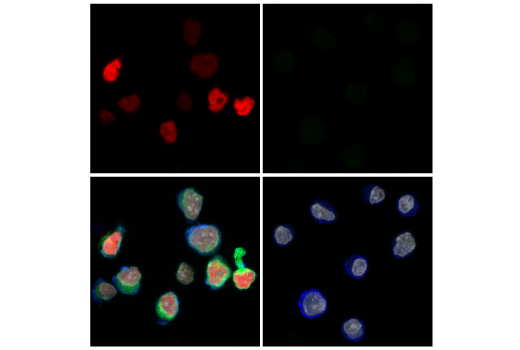 Immunofluorescence Image 3: TCF1/TCF7 (E6O1K) Rabbit mAb (Alexa Fluor® 647 Conjugate)