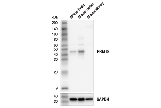  Image 10: PRMT Antibody Sampler Kit