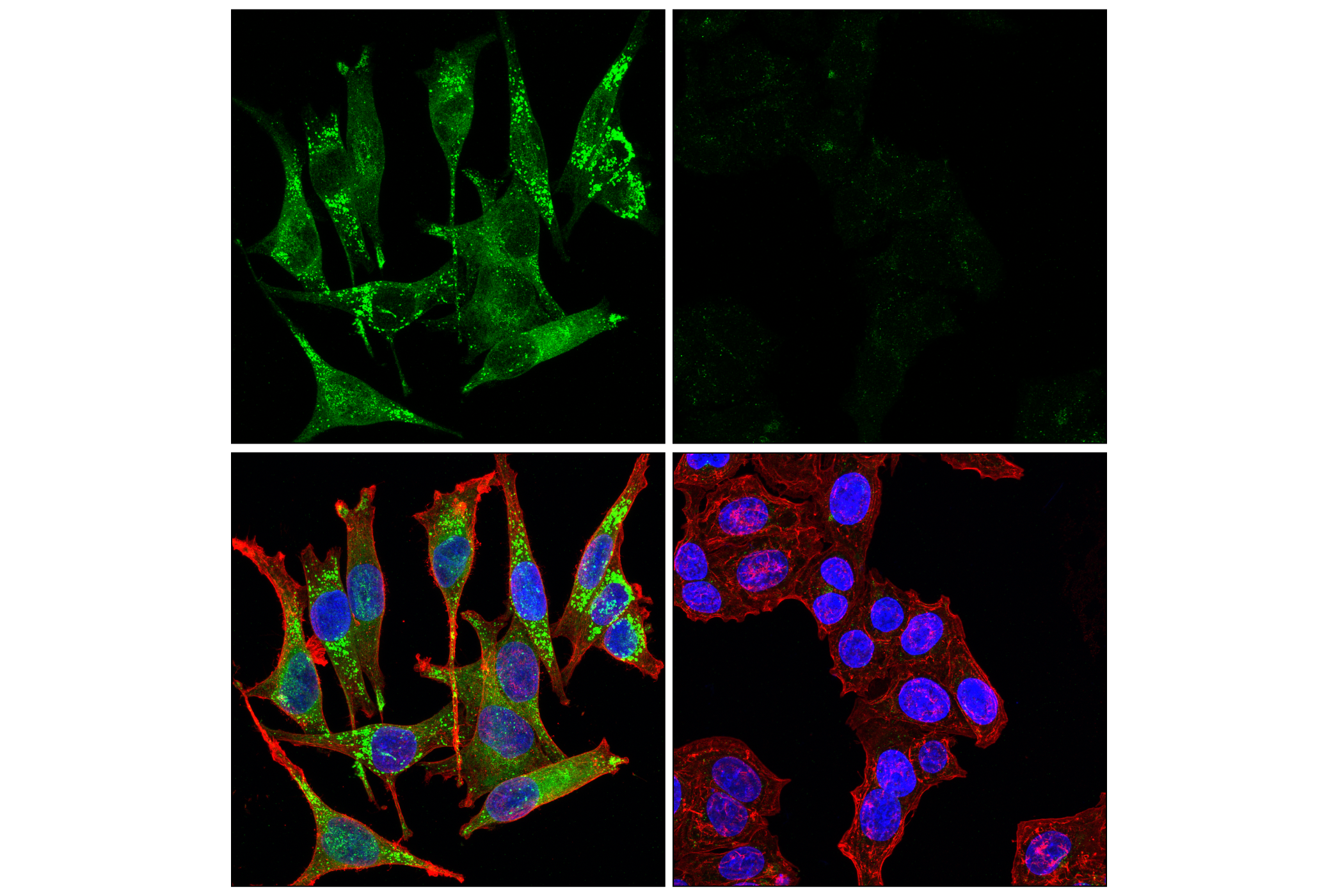 Immunofluorescence Image 1: ACSL3 (E2S9L) Rabbit mAb
