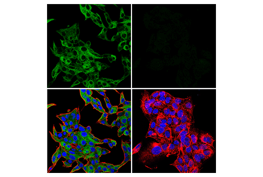 Immunofluorescence Image 1: FAM134B (E8Y9R) Rabbit mAb
