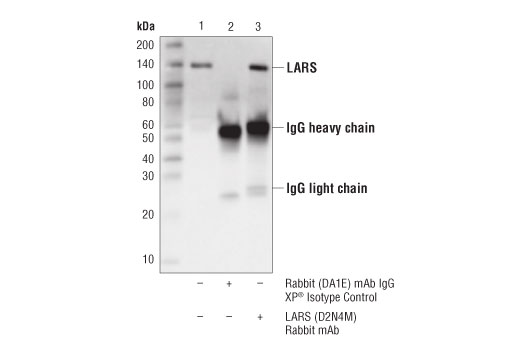 Immunoprecipitation Image 1: LARS (D2N4M) Rabbit mAb