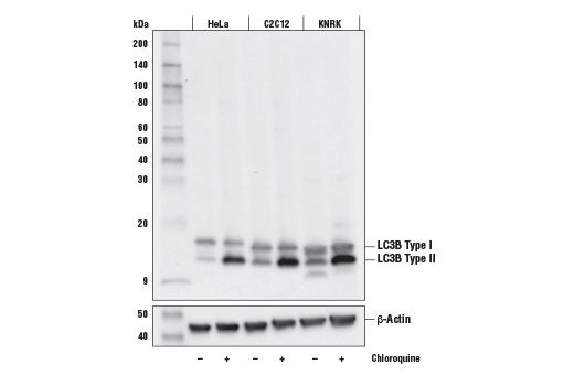  Image 19: Mouse Reactive Cell Death and Autophagy Antibody Sampler Kit