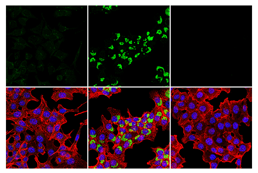  Image 61: Mouse Reactive Cell Death and Autophagy Antibody Sampler Kit