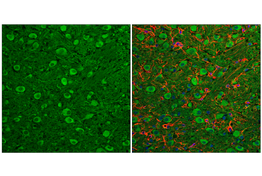 Immunofluorescence Image 2: LC3B (E5Q2K) Mouse mAb