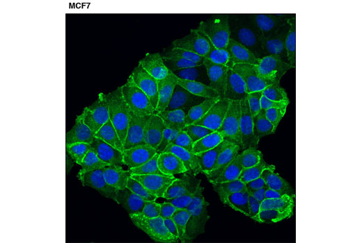 Immunofluorescence Image 1: NKCC1 (D13A9) Rabbit mAb