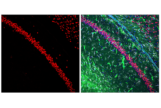 Immunofluorescence Image 2: EGR1 (15F7) Rabbit mAb (BSA and Azide Free)