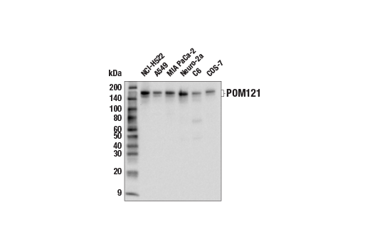 Western Blotting Image 1: POM121 Antibody