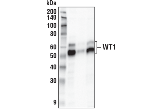 Immunoprecipitation Image 1: WT1 (D8I7F) XP® Rabbit mAb