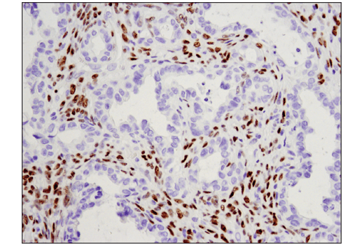 Immunohistochemistry Image 3: WT1 (D8I7F) XP® Rabbit mAb