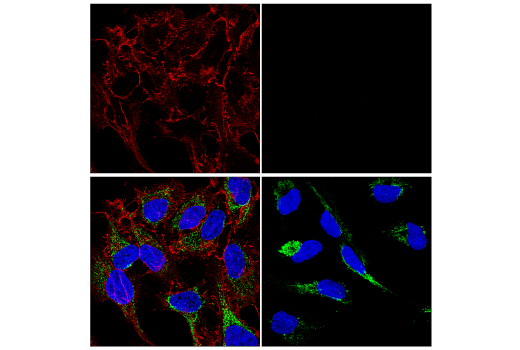 Immunofluorescence Image 2: β-Catenin (D10A8) XP® Rabbit mAb (Alexa Fluor® 555 Conjugate)