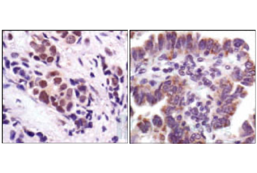 Immunohistochemistry Image 5: Stat3 (124H6) Mouse mAb (BSA and Azide Free)