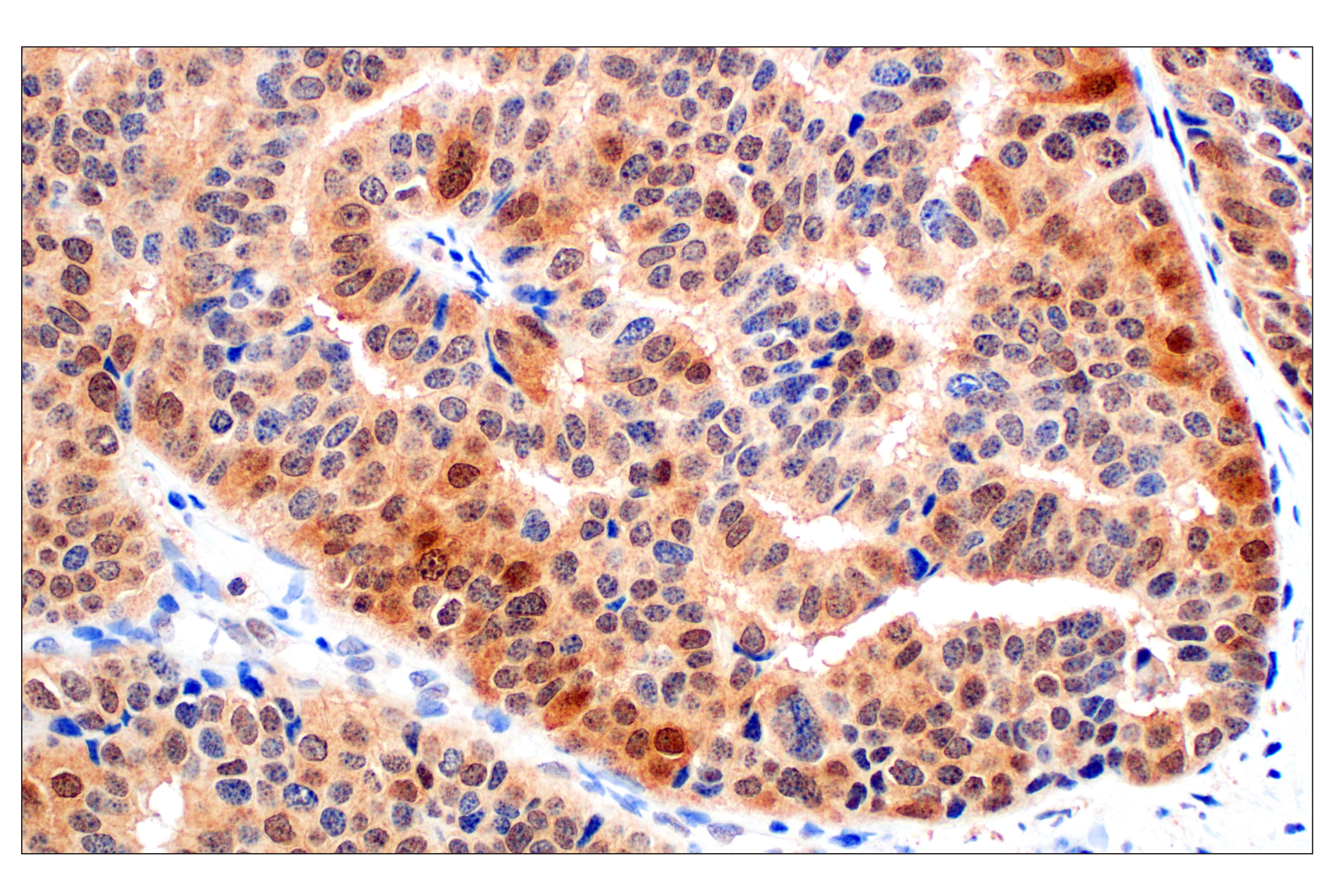 Immunohistochemistry Image 4: Stat3 (124H6) Mouse mAb (BSA and Azide Free)