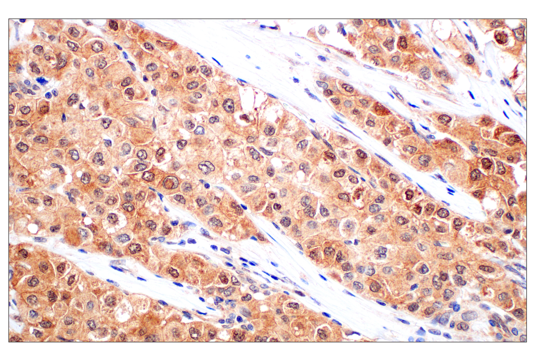 Immunohistochemistry Image 3: Stat3 (124H6) Mouse mAb (BSA and Azide Free)