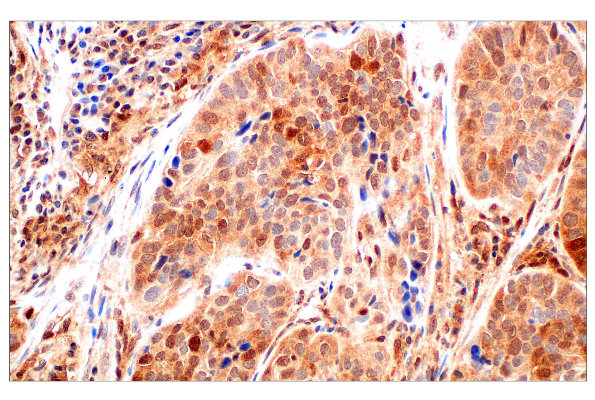 Immunohistochemistry Image 2: Stat3 (124H6) Mouse mAb (BSA and Azide Free)