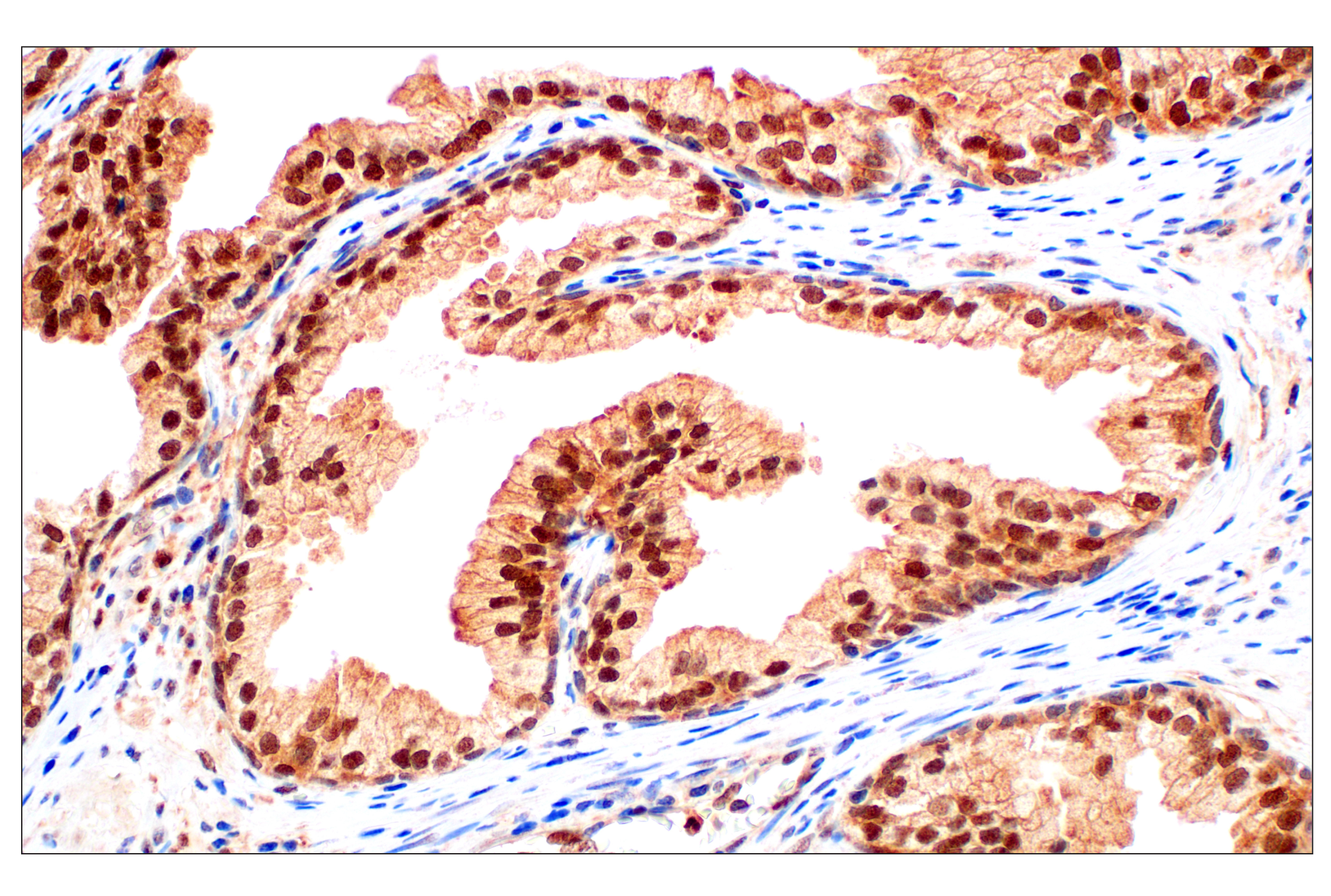 Immunohistochemistry Image 1: Stat3 (124H6) Mouse mAb (BSA and Azide Free)