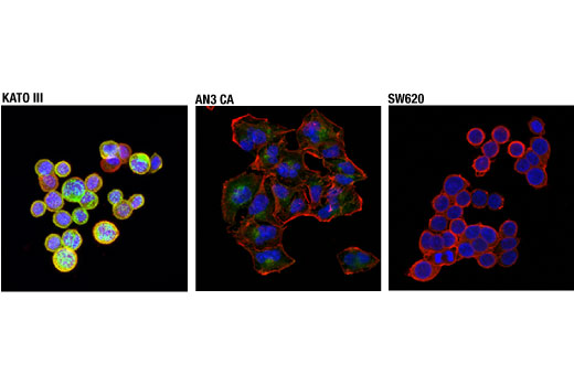 Immunofluorescence Image 1: FGF Receptor 2 (D4L2V) Rabbit mAb (BSA and Azide Free)