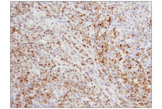 Immunohistochemistry Image 4: p27 Kip1 (SX53G8.5) Mouse mAb (IHC Formulated)