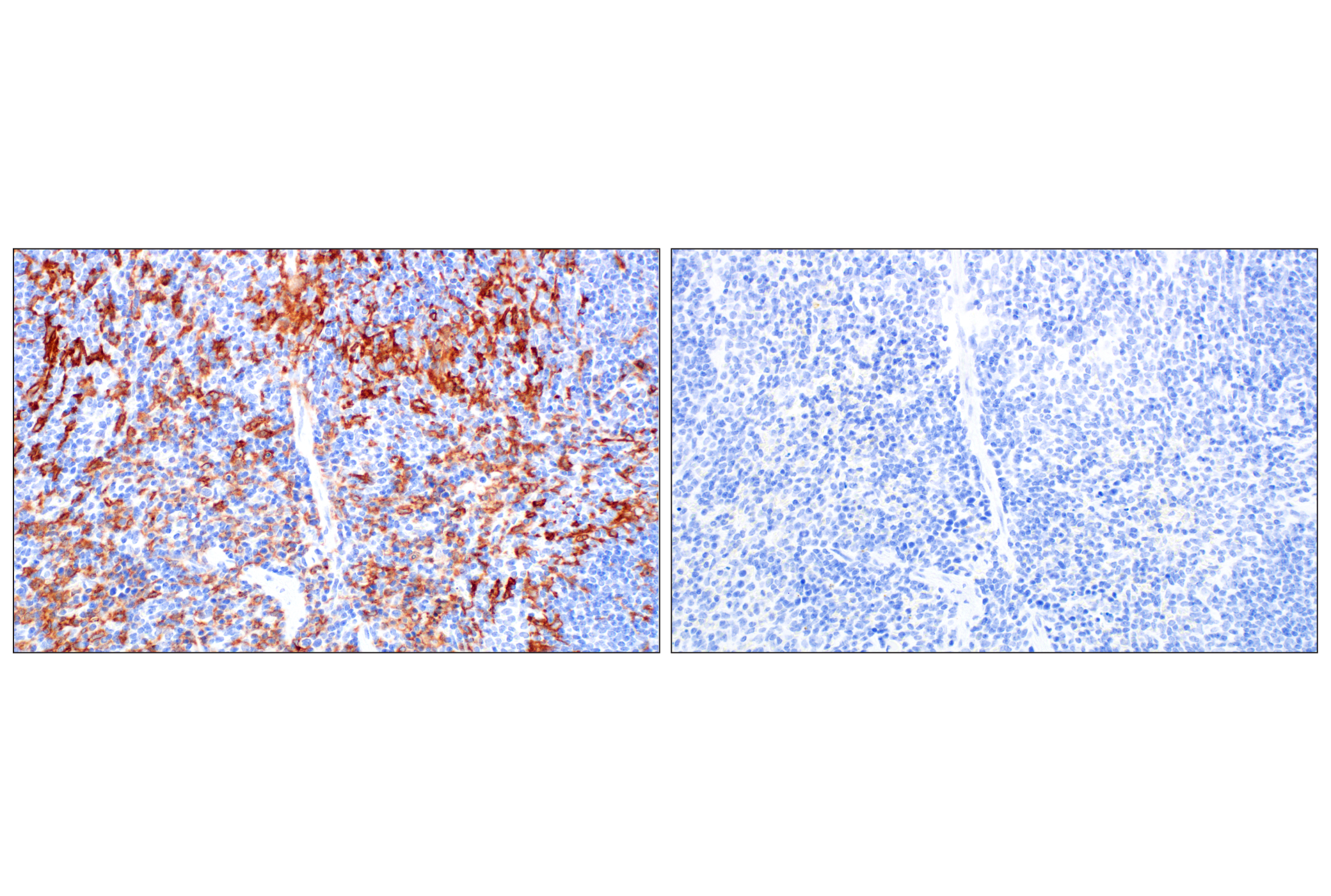 CSF-1R/M-CSF-R (F1H1I) Rabbit Monoclonal Antibody | Cell Signaling