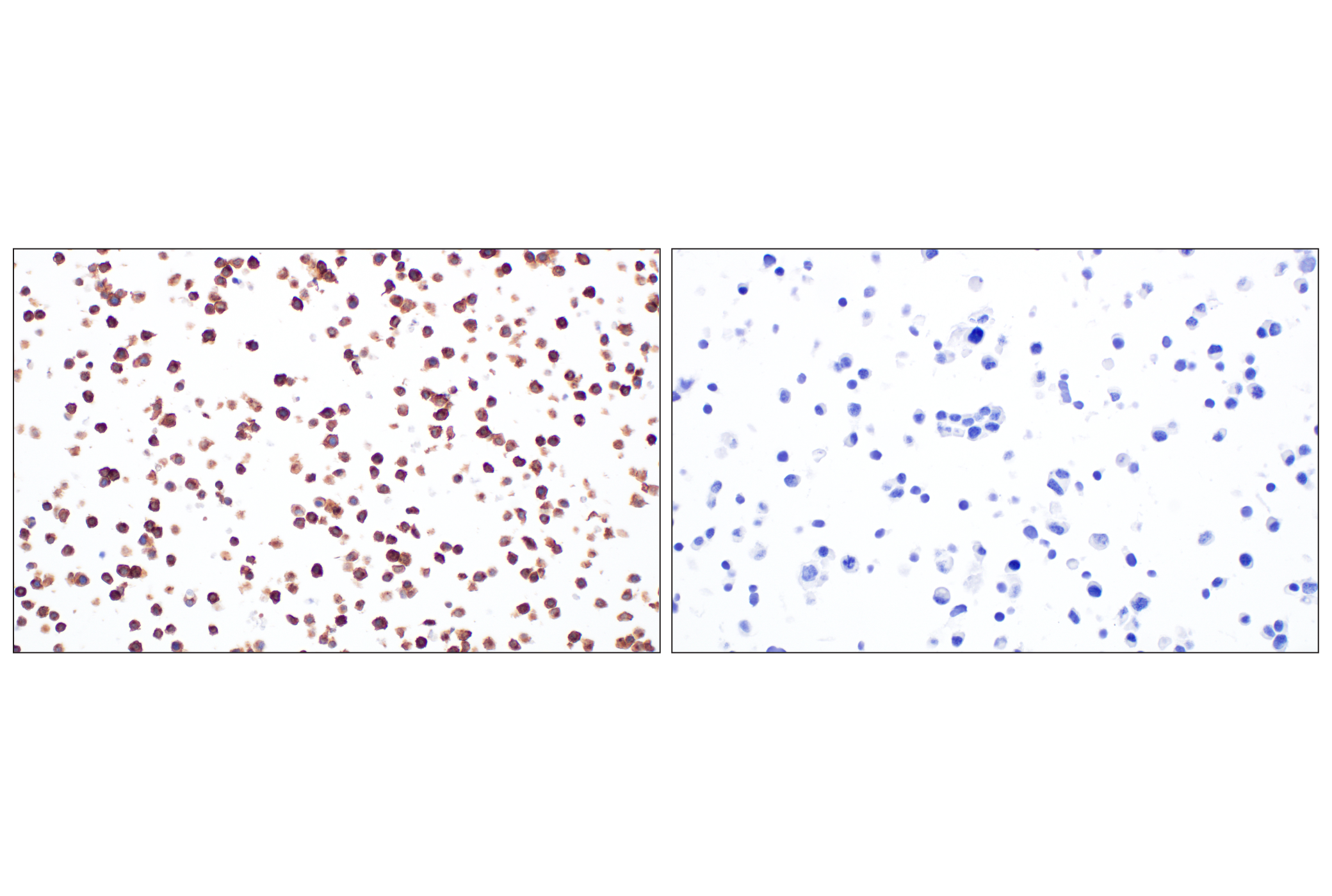 CSF-1R/M-CSF-R (F1H1I) Rabbit Monoclonal Antibody | Cell Signaling