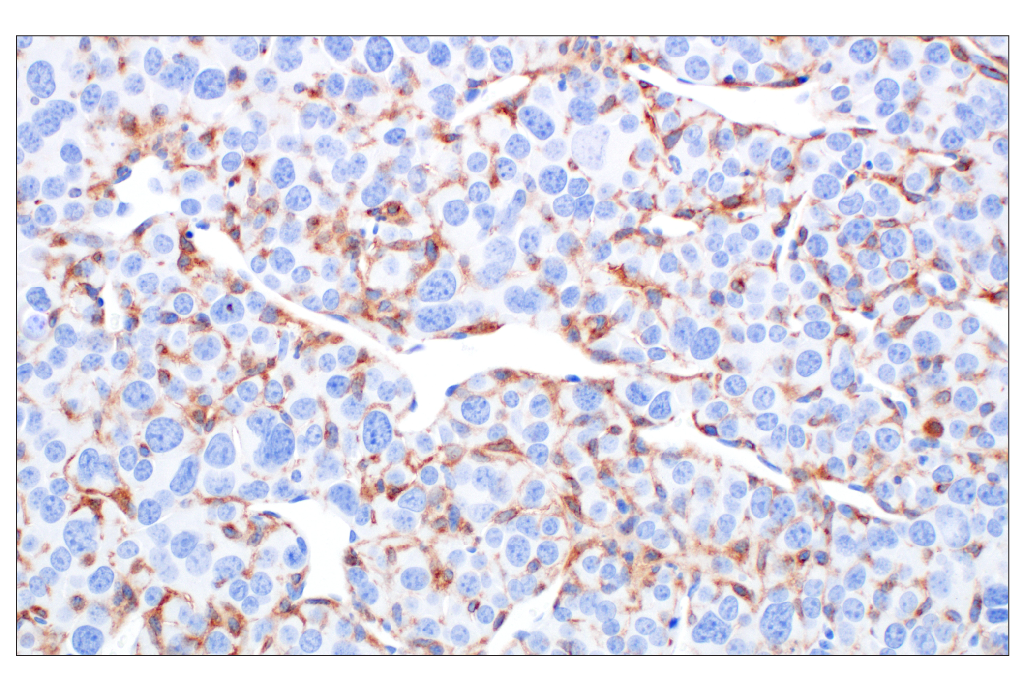 CSF-1R/M-CSF-R (F1H1I) Rabbit Monoclonal Antibody | Cell Signaling