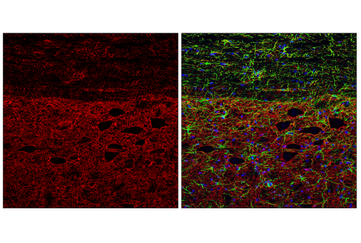 Immunofluorescence Image 1: Connexin 43 (E7N2R) XP® Rabbit mAb