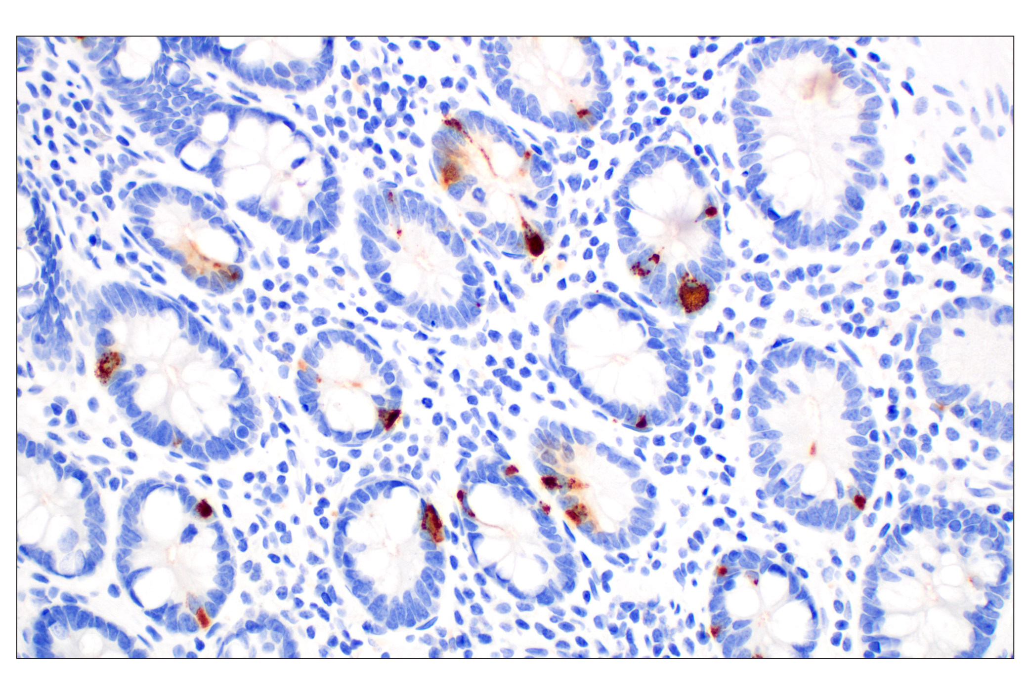Immunohistochemistry Image 3: CHGA (F7D6H) Rabbit mAb